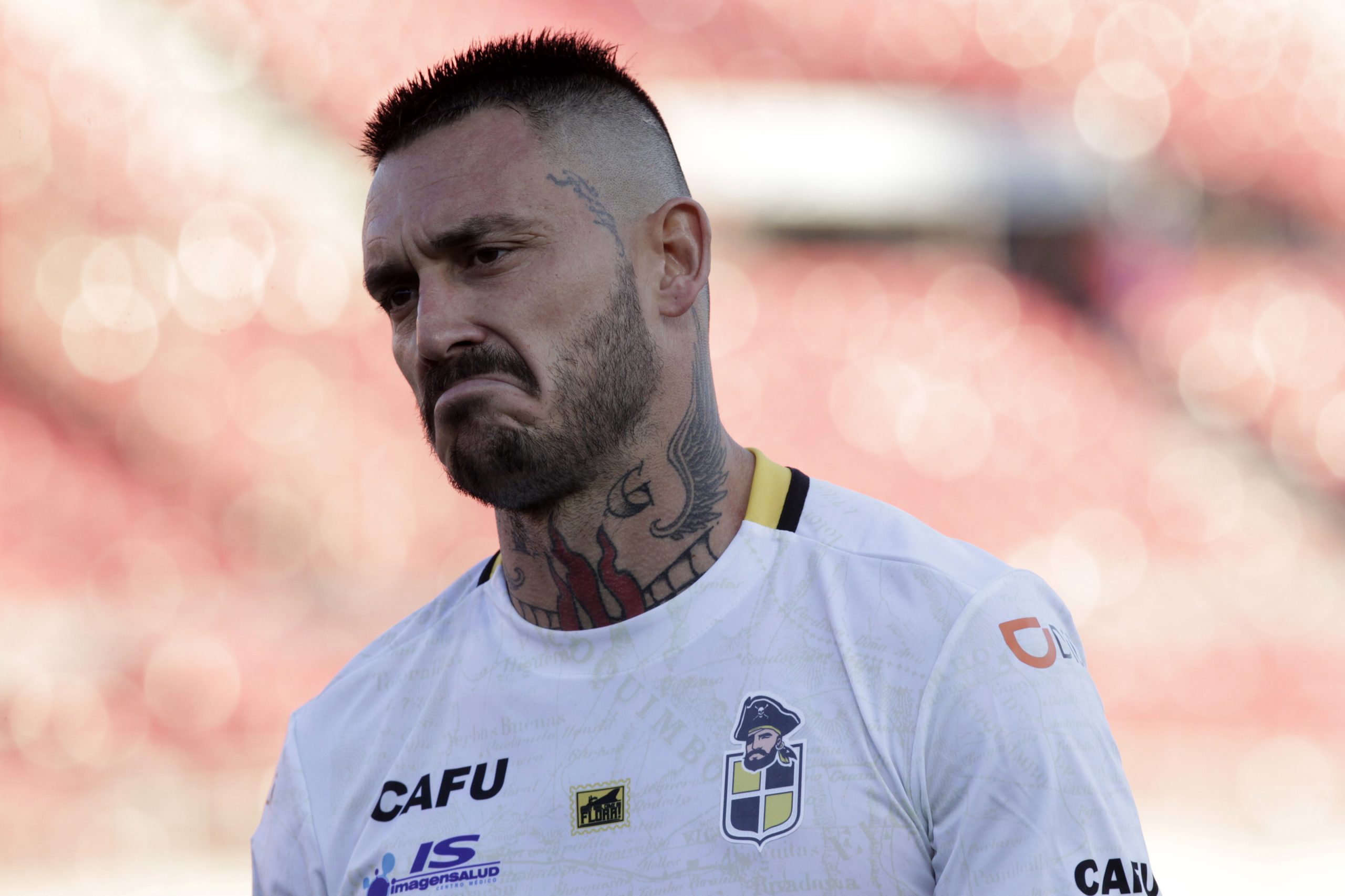 (Foto) Así quedó el tobillo de Mauricio Pinilla tras sufrir fuerte entrada