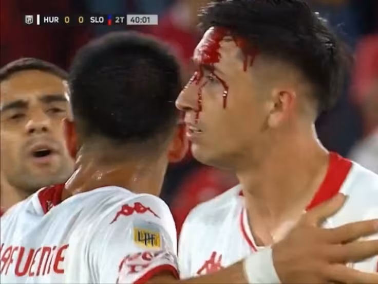 Video: Rodrigo Echeverría sufrió grave golpe en el clásico entre Huracán y San Lorenzo