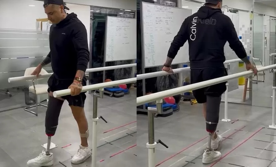 Video: Cristóbal Campos comenzó su rehabilitación con moderna prótesis