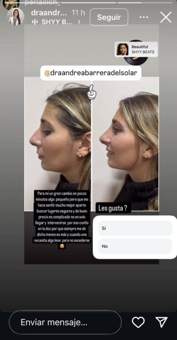perla antes y despues