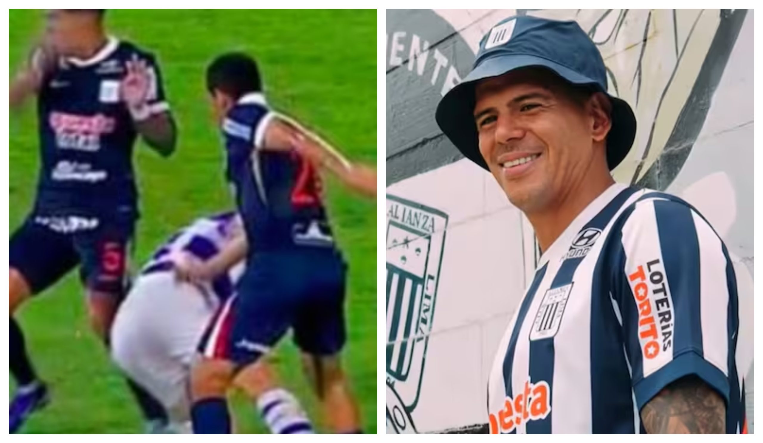 lesion esteban pavez