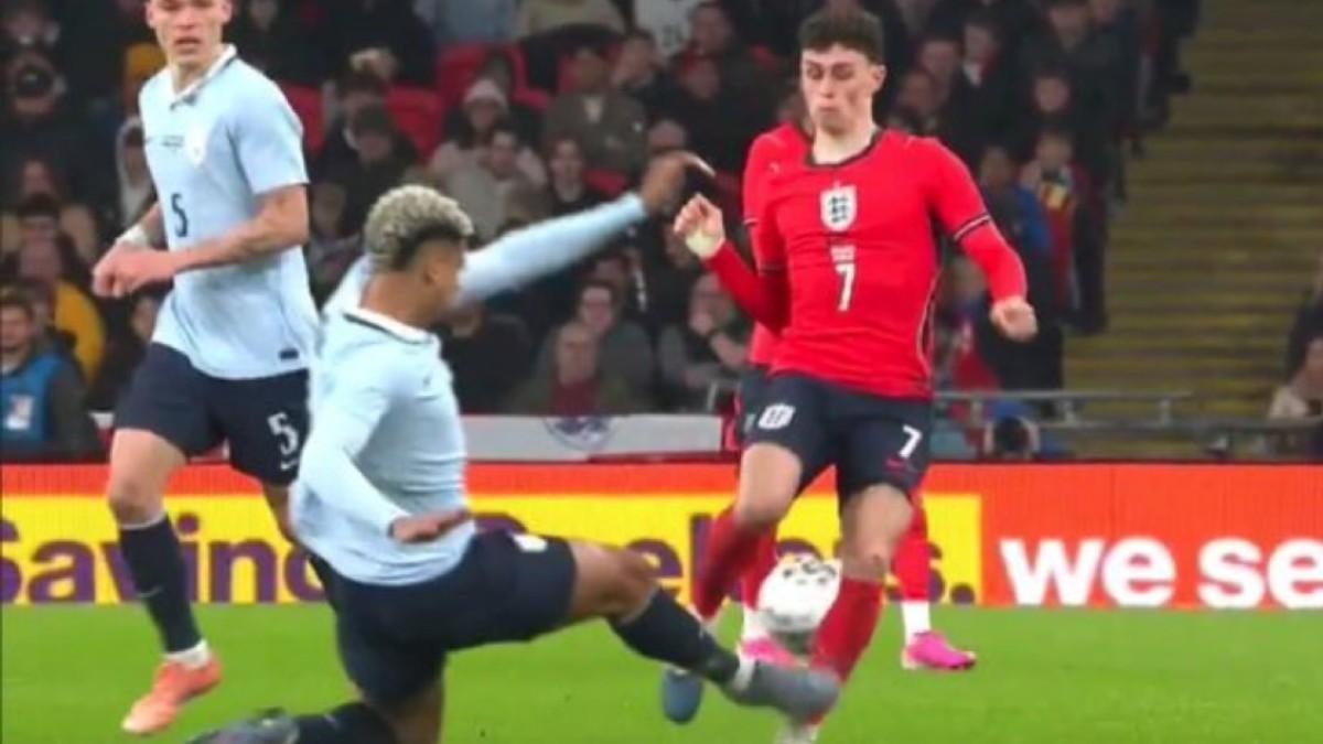 lesion foden