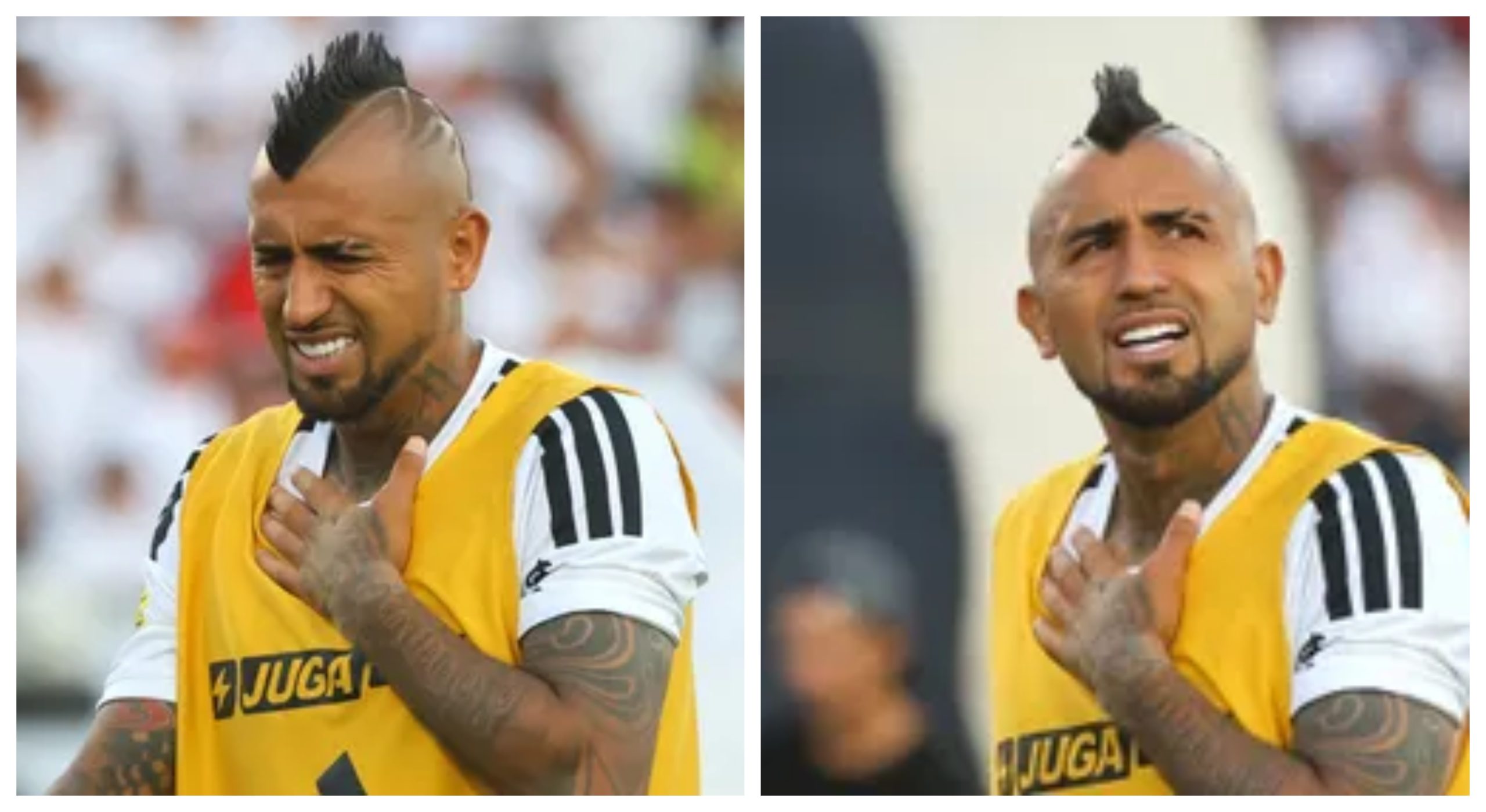 lesion vidal