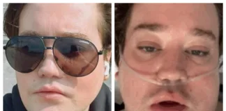 Nico Yunge preocupa tras revelar que está hospitalizado en Londres y compartir enigmático video