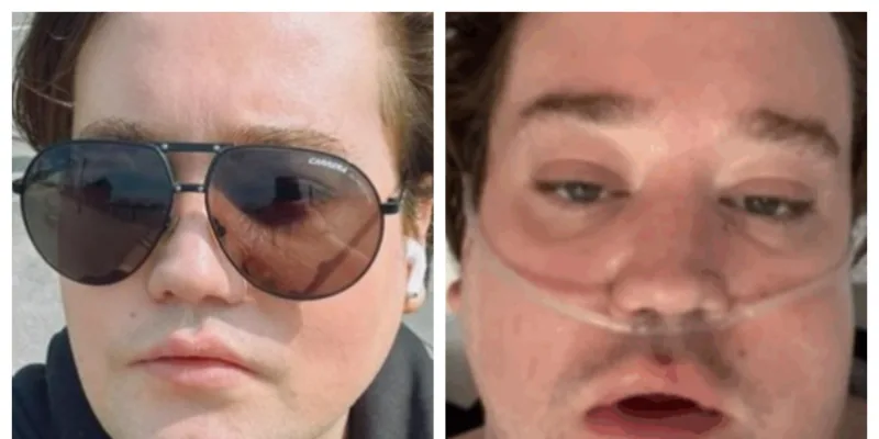 Nico Yunge preocupa tras revelar que está hospitalizado en Londres y compartir enigmático video