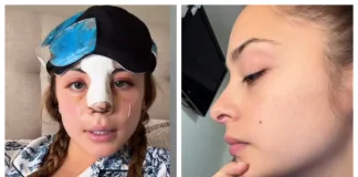 Skarleth Labra se cansó de las críticas y respondió a los comentarios sobre su cirugía