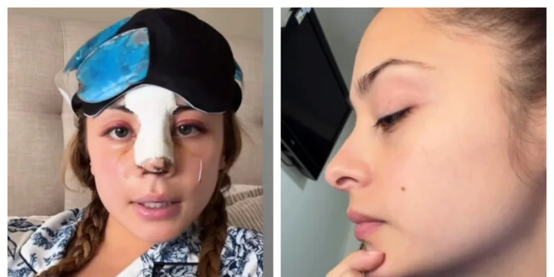 Skarleth Labra se cansó de las críticas y respondió a los comentarios sobre su cirugía
